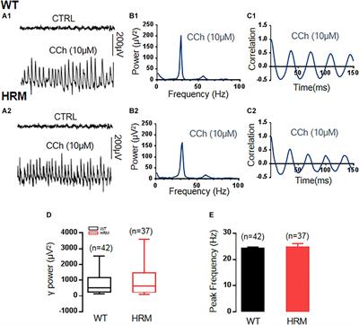 Modulation of Hippocampal Gamma Oscillations by Dopamine in Heterozygous Reeler Mice in vitro